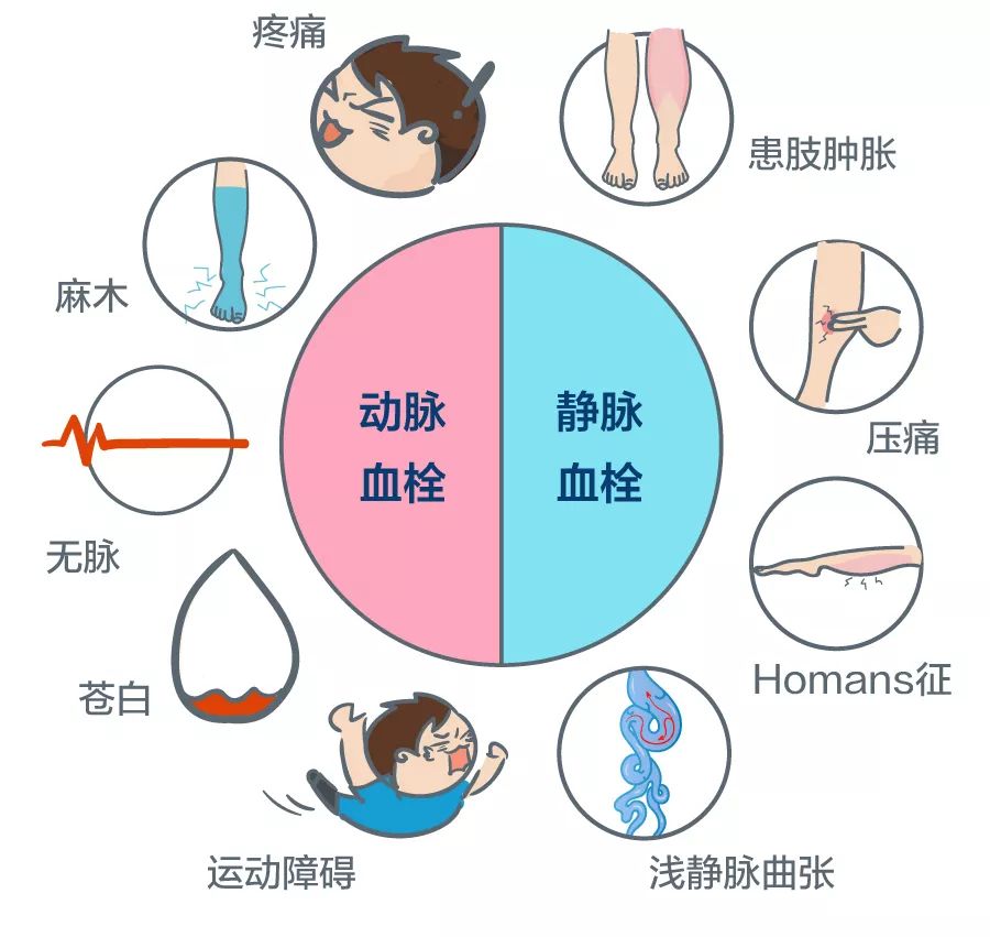 静脉曲张血栓.jpg