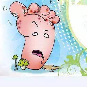 糖尿病足2.jpg